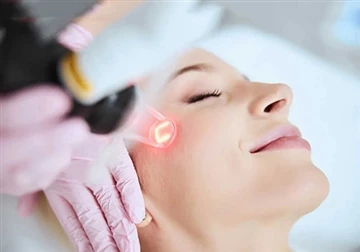 Bagaimanakah Laser Boleh Digunakan dalam Rawatan Kosmetik?
