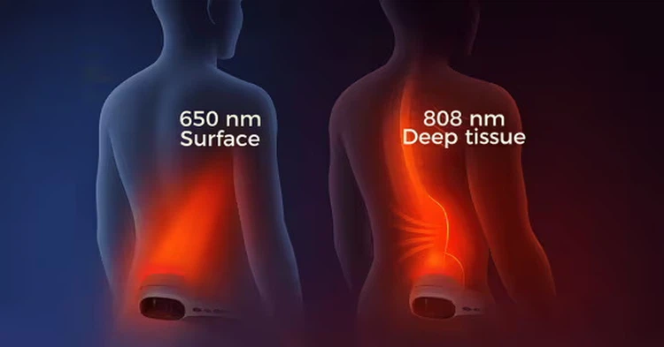 Laser treatment for osteoarthritis Laser treatment for osteoarthritis