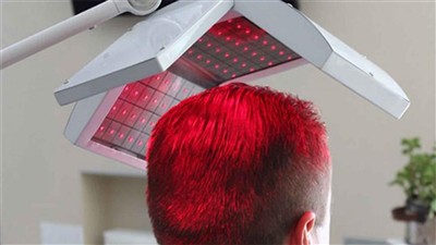 Apakah Modul Laser Yang Digunakan dalam Rawatan Pertumbuhan Rambut Laser?
